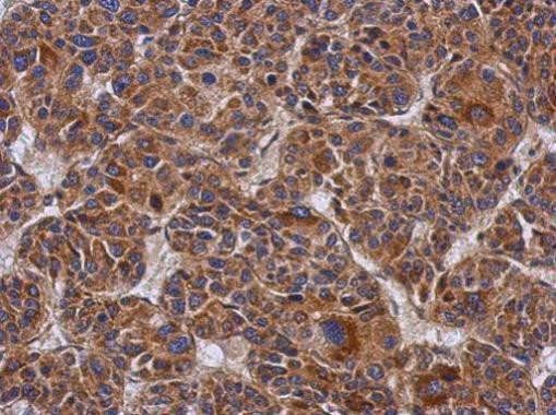 Ymer Antibody in Immunohistochemistry (Paraffin) (IHC (P))