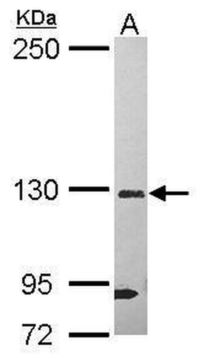 DHX37 Antibody in Western Blot (WB)