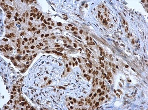 DDX39 Antibody in Immunohistochemistry (Paraffin) (IHC (P))