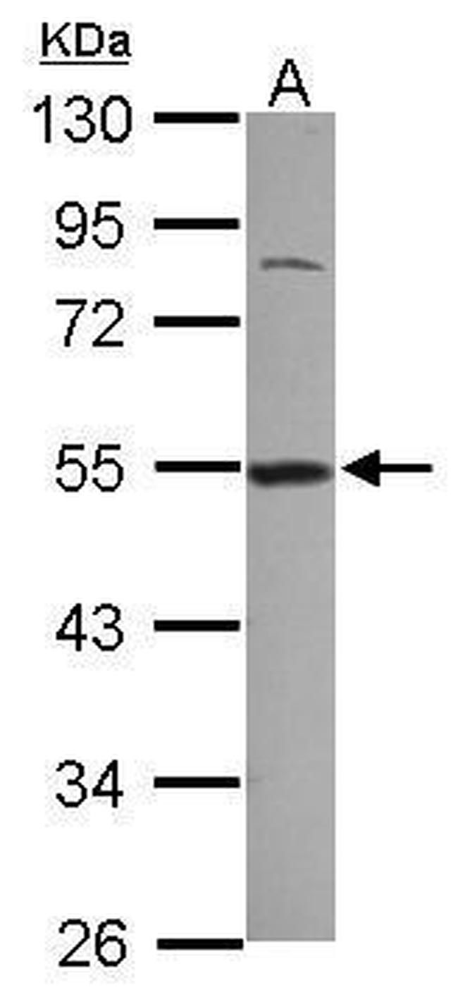 DDX39 Antibody in Western Blot (WB)