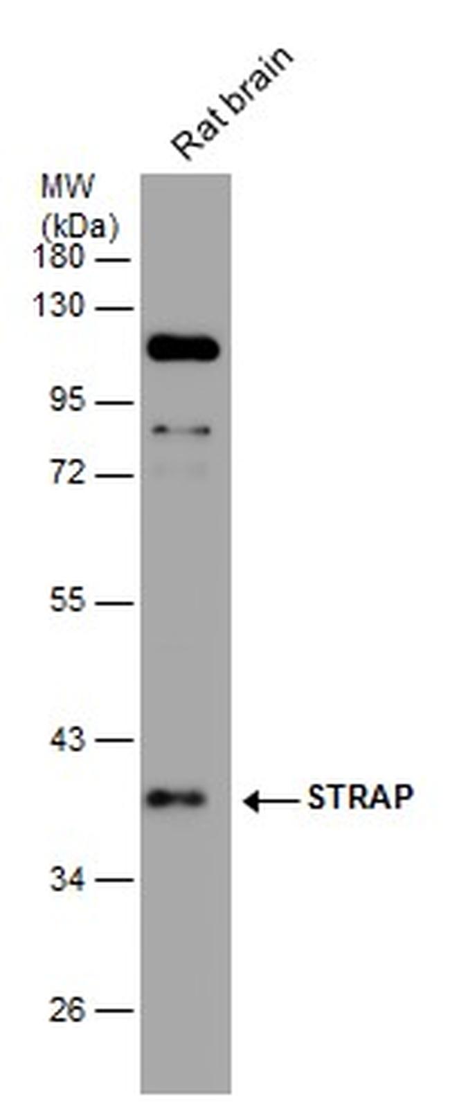 STRAP Antibody in Western Blot (WB)