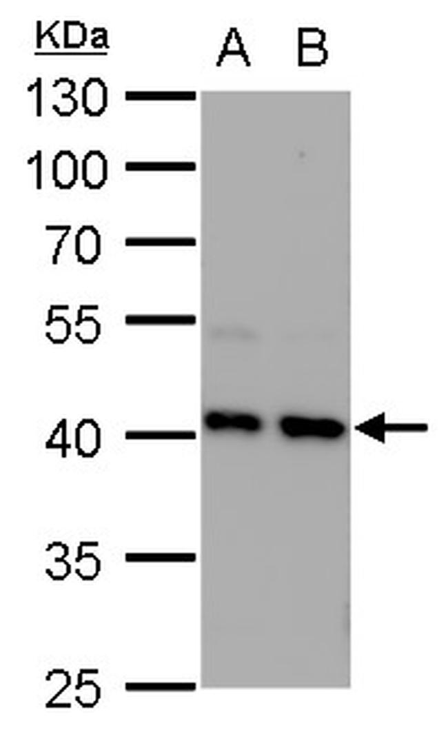 STRAP Antibody in Western Blot (WB)