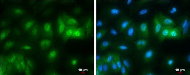 RBPMS Antibody in Immunocytochemistry (ICC/IF)