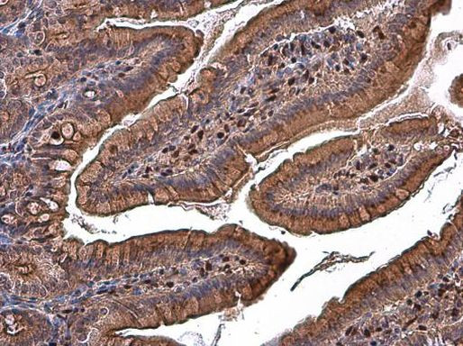 RBPMS Antibody in Immunohistochemistry (Paraffin) (IHC (P))