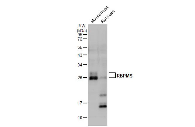 RBPMS Antibody in Western Blot (WB)