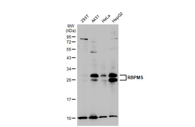 RBPMS Antibody in Western Blot (WB)