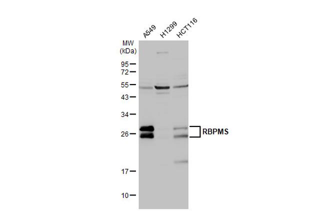 RBPMS Antibody in Western Blot (WB)