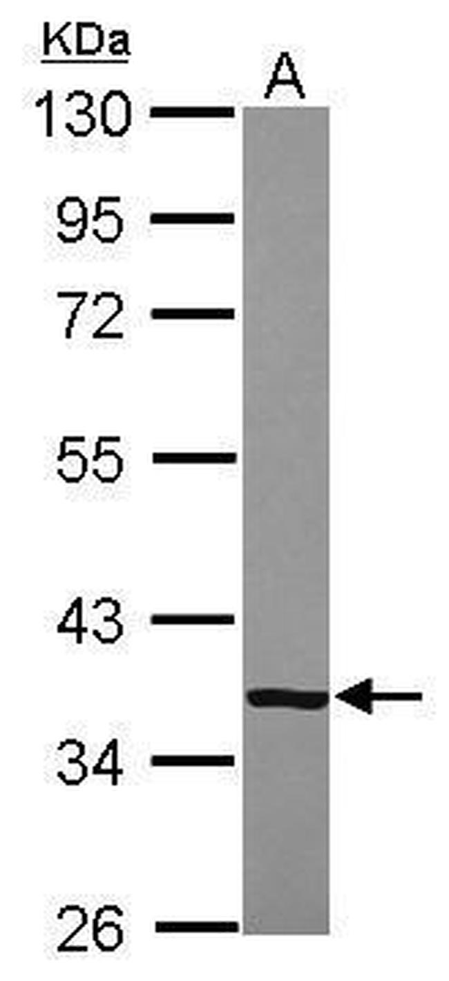 CFHR1 Antibody in Western Blot (WB)