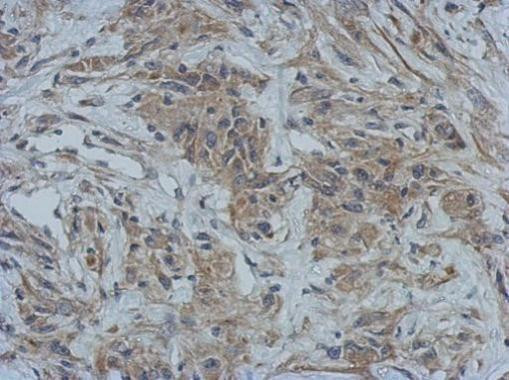 GBP5 Antibody in Immunohistochemistry (Paraffin) (IHC (P))