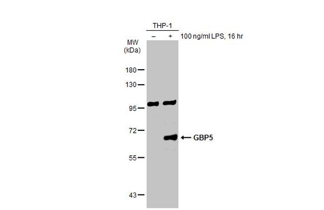 GBP5 Antibody in Western Blot (WB)