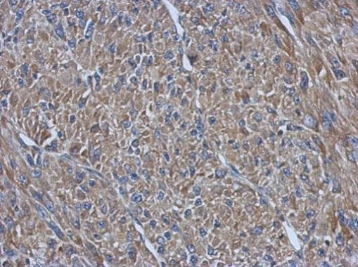 PRPSAP2 Antibody in Immunohistochemistry (Paraffin) (IHC (P))