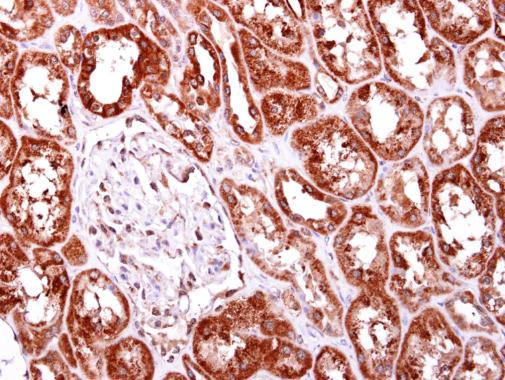 JTV-1 Antibody in Immunohistochemistry (Paraffin) (IHC (P))