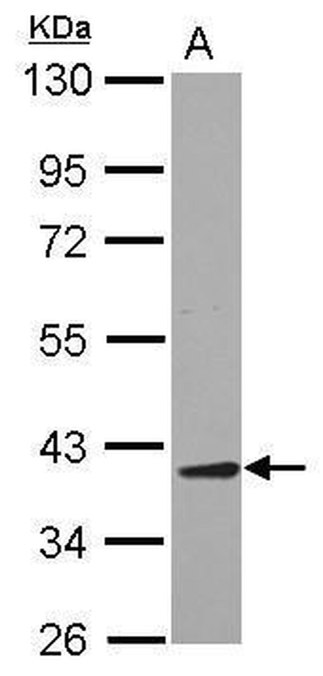 JTV-1 Antibody in Western Blot (WB)