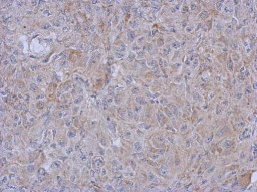 MRPL10 Antibody in Immunohistochemistry (Paraffin) (IHC (P))