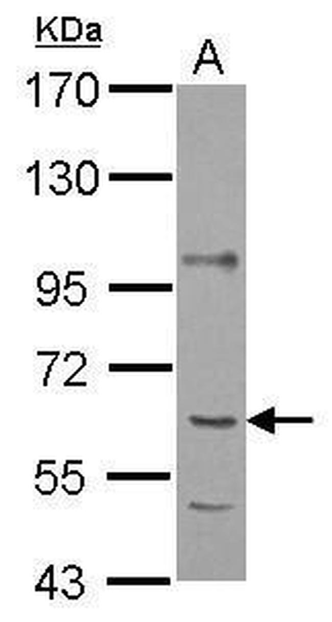 P4HA1 Antibody in Western Blot (WB)