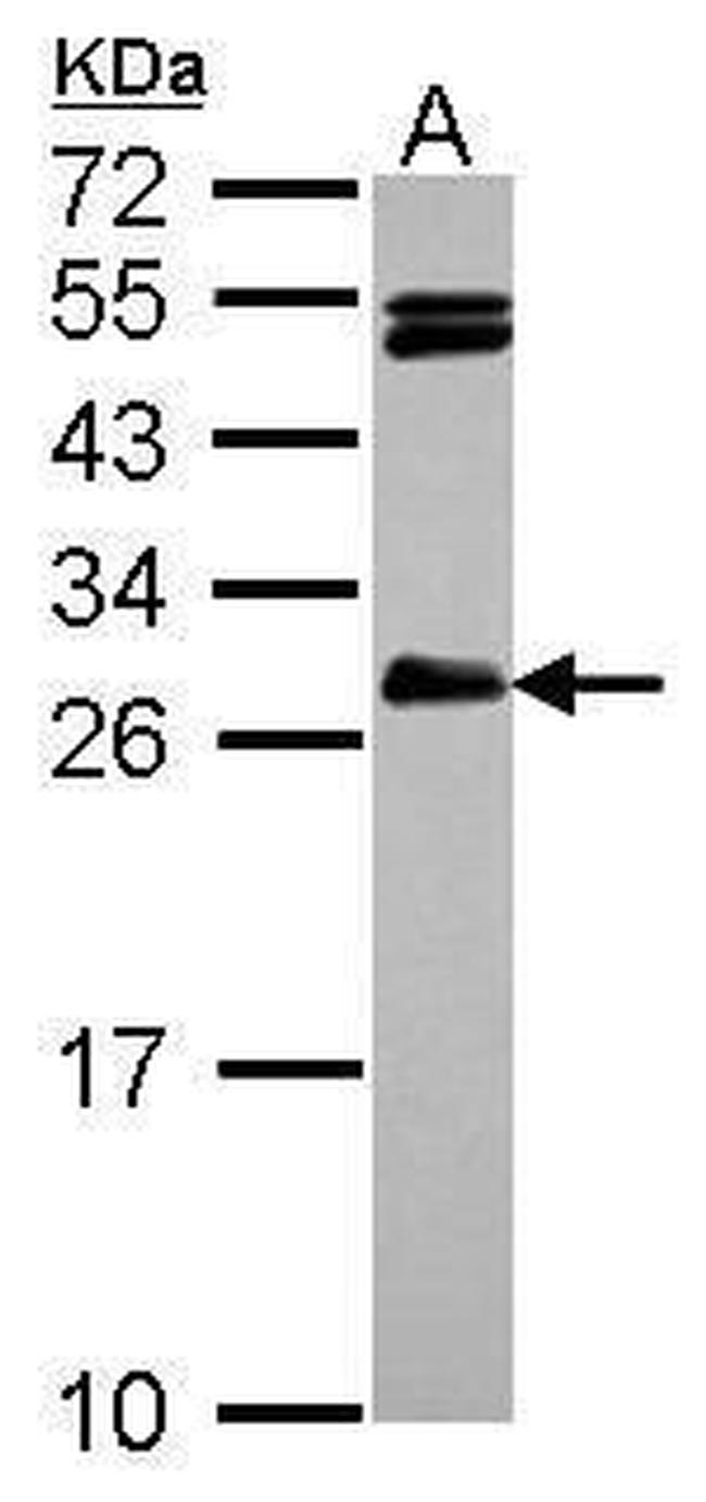 HAUS2 Antibody in Western Blot (WB)