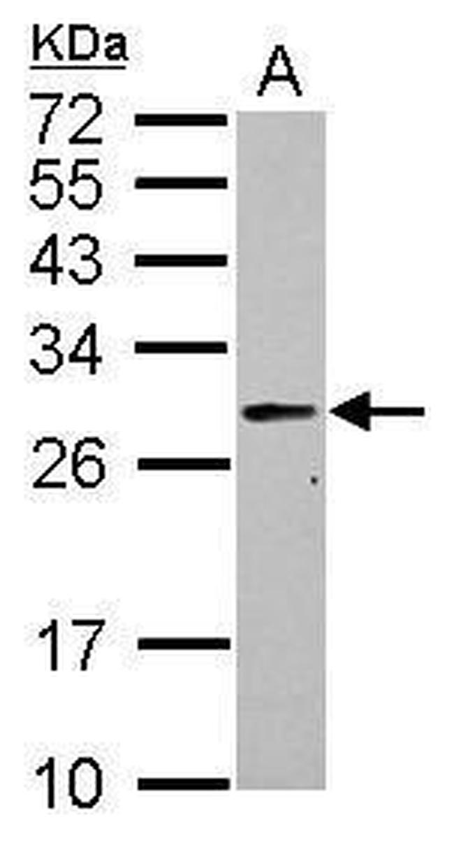 PRTFDC1 Antibody in Western Blot (WB)