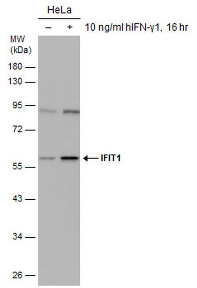 IFIT1 Antibody in Western Blot (WB)