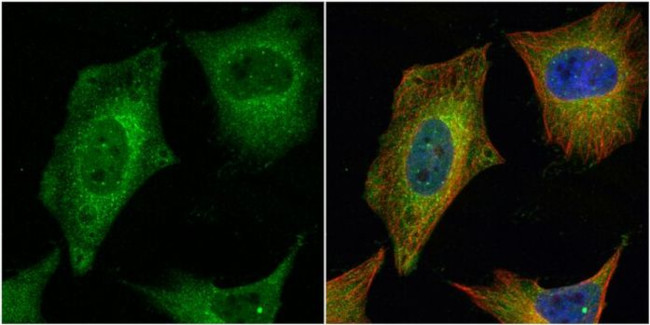 HAUS2 Antibody in Immunocytochemistry (ICC/IF)