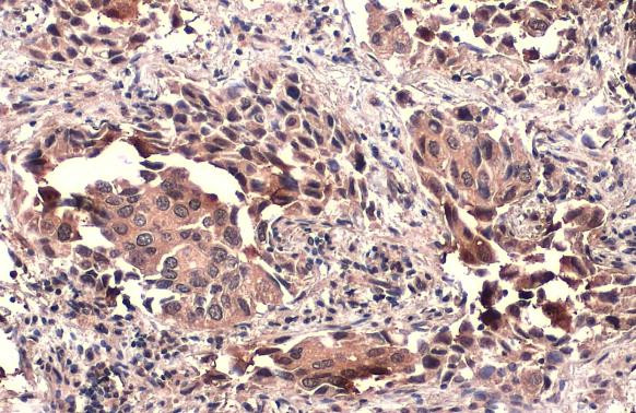 TSG101 Antibody in Immunohistochemistry (Paraffin) (IHC (P))