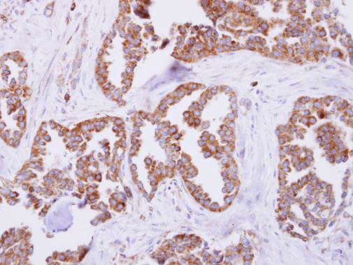 MRPL11 Antibody in Immunohistochemistry (Paraffin) (IHC (P))