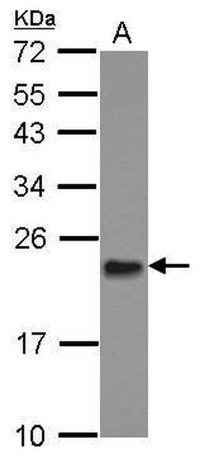 MRPL11 Antibody in Western Blot (WB)