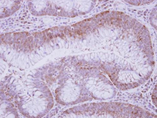 GFOD2 Antibody in Immunohistochemistry (Paraffin) (IHC (P))