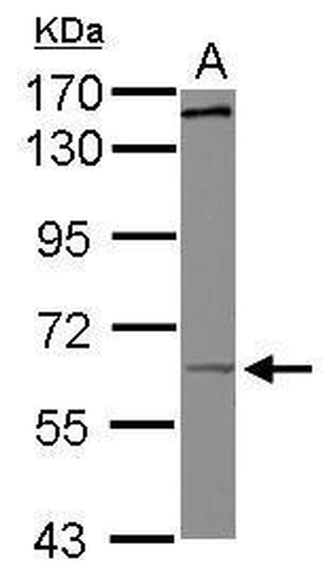 KIF19 Antibody in Western Blot (WB)