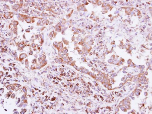 PTPN14 Antibody in Immunohistochemistry (Paraffin) (IHC (P))