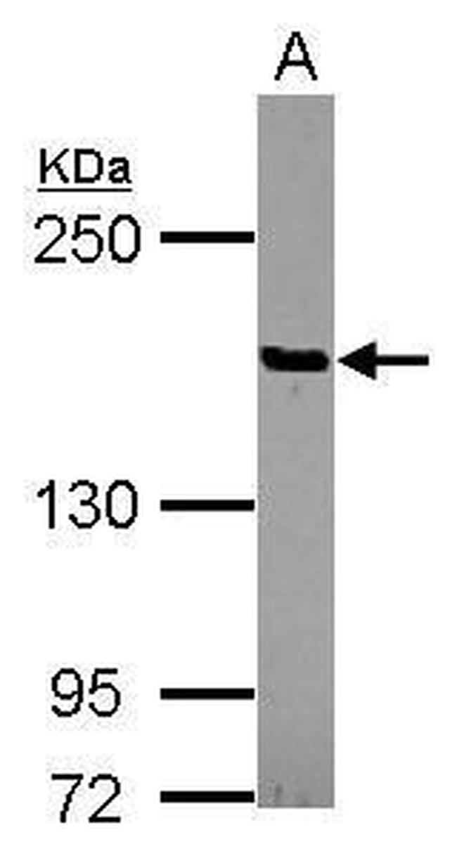 PTPN14 Antibody in Western Blot (WB)