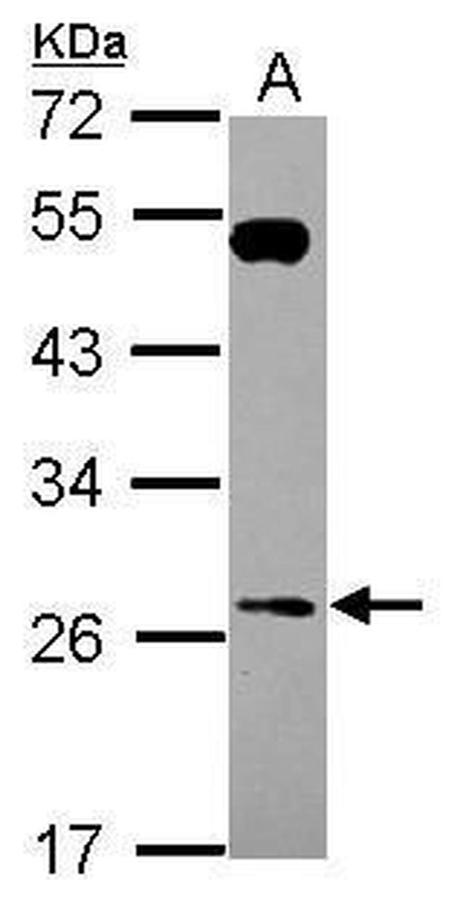 RAB26 Antibody in Western Blot (WB)