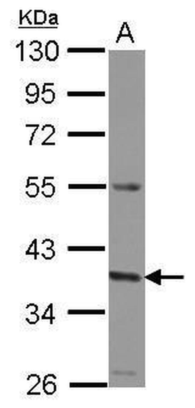 GNA11 Antibody in Western Blot (WB)