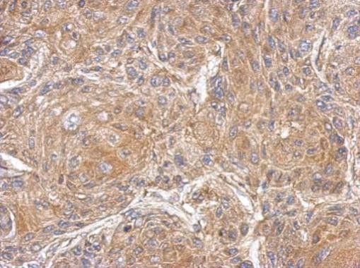 PDE10A Antibody in Immunohistochemistry (Paraffin) (IHC (P))