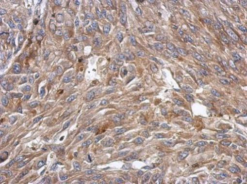 KCTD4 Antibody in Immunohistochemistry (Paraffin) (IHC (P))