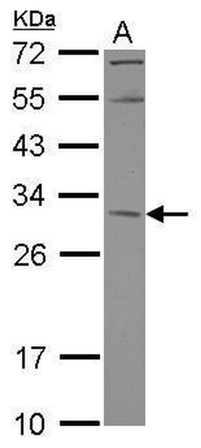 KCTD4 Antibody in Western Blot (WB)