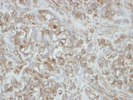 PCDHA3 Antibody in Immunohistochemistry (Paraffin) (IHC (P))