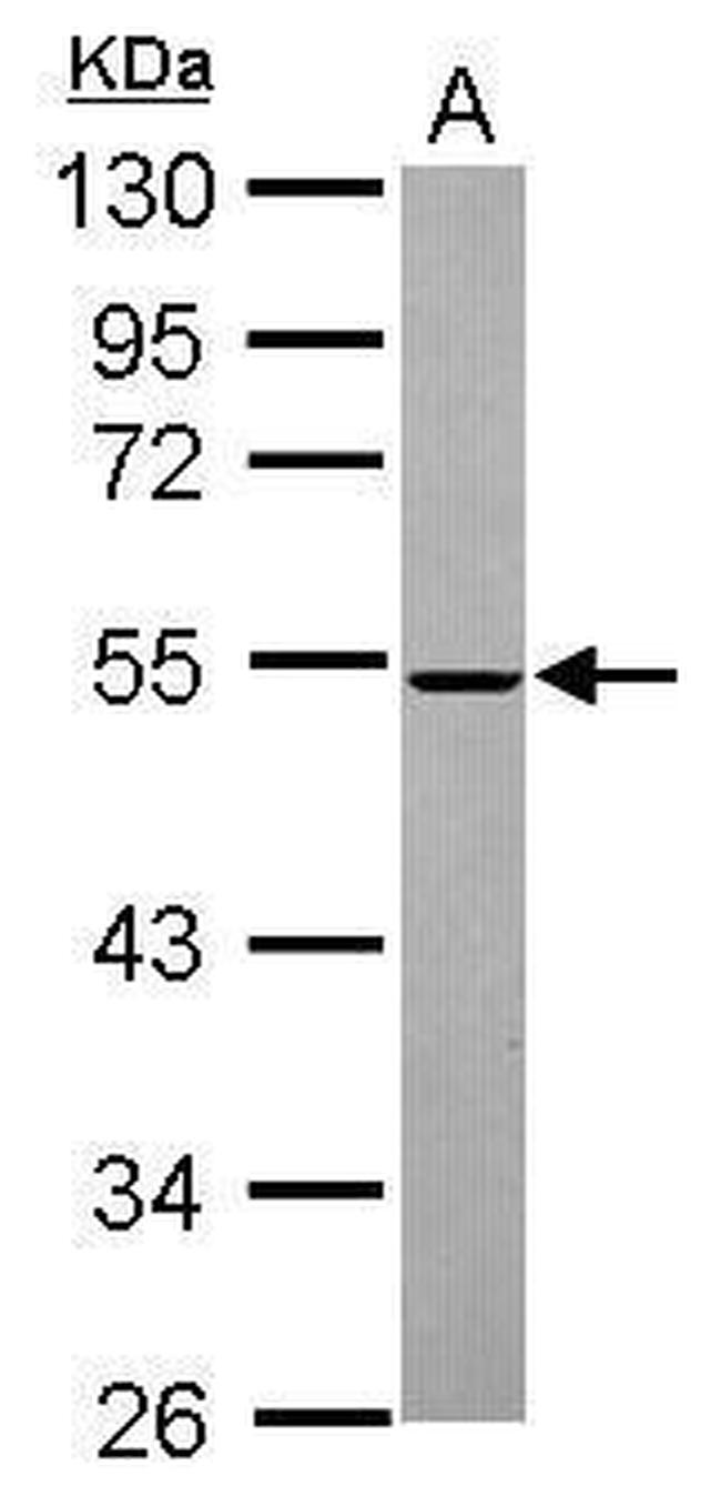 MINA53 Antibody in Western Blot (WB)