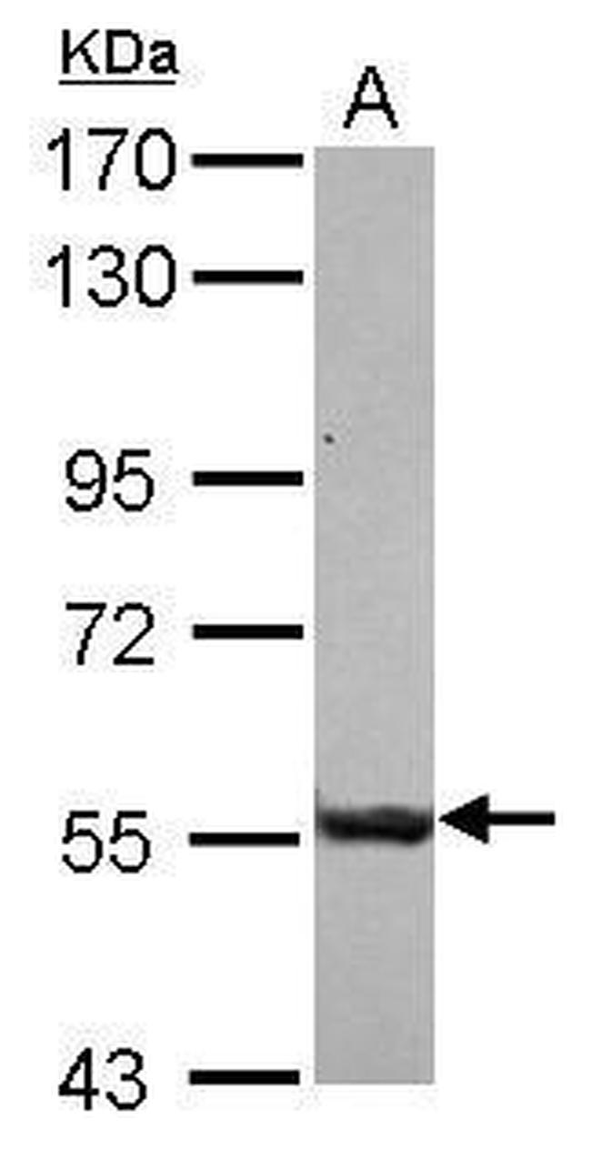 SASS6 Antibody in Western Blot (WB)