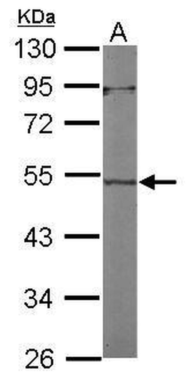 Actin-like 7A Antibody in Western Blot (WB)