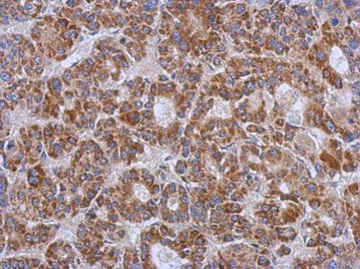 ZSWIM2 Antibody in Immunohistochemistry (Paraffin) (IHC (P))