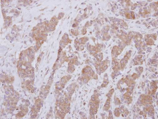 OASL Antibody in Immunohistochemistry (Paraffin) (IHC (P))