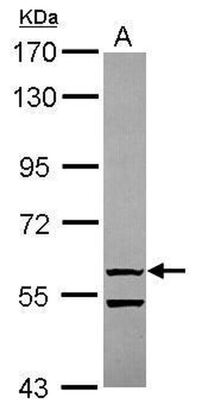 OASL Antibody in Western Blot (WB)