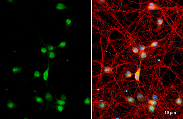 RAB11B Antibody in Immunocytochemistry (ICC/IF)