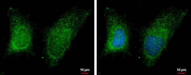 RAB11B Antibody in Immunocytochemistry (ICC/IF)