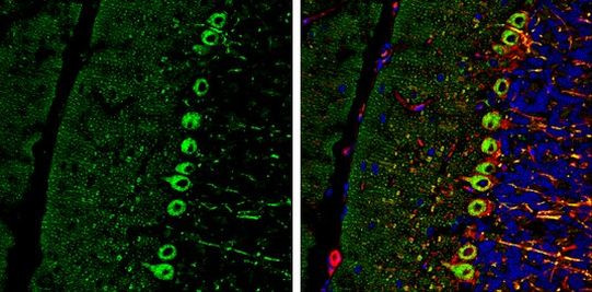 RAB11B Antibody in Immunohistochemistry (Frozen) (IHC (F))