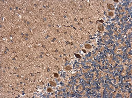 RAB11B Antibody in Immunohistochemistry (Paraffin) (IHC (P))