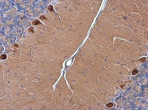 RAB11B Antibody in Immunohistochemistry (Paraffin) (IHC (P))