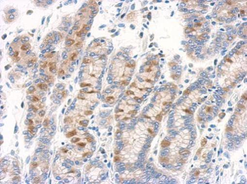 RAB11B Antibody in Immunohistochemistry (Paraffin) (IHC (P))