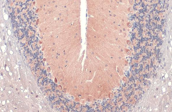 RAB11B Antibody in Immunohistochemistry (Paraffin) (IHC (P))