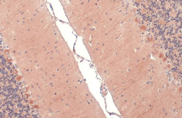 RAB11B Antibody in Immunohistochemistry (Paraffin) (IHC (P))